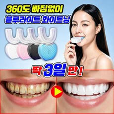 [세정+미백] 풀형 미백 치아 미백기 U자형 전동칫솔 치아미백기 u형 자동 칫솔 치아 화이트닝 메이크업 치아미백 가정용 U자형 SUOSER, 1세트, 화이트