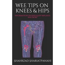 (영문도서) Wee Tips on Knees & Hips: Information on Knee & Hip Implants and More Paperback, Independently Published, English, 9798648485570