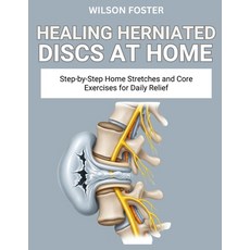 (영문도서)Healing Herniated Discs at Home: Safe Spine-Friendly Movements to Relieve Nerve... Paperback, Independently Published, English, 9798268756012