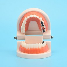 치과 치아 모형 교육 모델 브라켓 구강 덴티폼, 리얼 모델 (치아는 분리할 수 없음)
