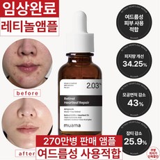 트러블 진정 피지감소 임상검증 모공면적감소 여드름성 사용적합 임상완료 [340만병 판매기념 할인] 고함량 레티놀 어성초 히알루론산 나이아신아마이드 뮤아마 앰플, 1개, 30ml