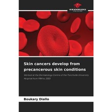 (영문도서)Skin cancers develop from precancerous skin conditions Paperback, Our Knowledge Publishing, English, 9786209446696 Our Knowledge Publishing, English, 9786209446696