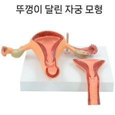 모의 모형 병리 나팔관 해부 병적 가족계획 지도 시연 리버스, 1개