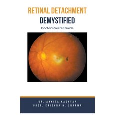 (영문도서) Retinal Detachment Demystified: Doctor's Secret Guide Paperback, Virtued Press, English, 9798223521396