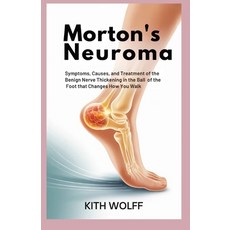 (영문도서)Morton's Neuroma: Symptoms Causes and Treatment of the Benign Nerve Thickening... Paperback, Independently Published, English, 9798275354232