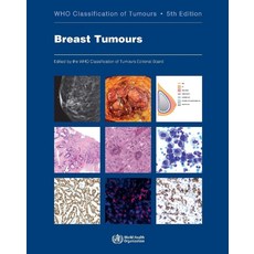 Breast Tumours:, WHO