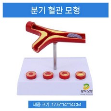 심혈관모형 동맥경화혈관모형 해부학 교육용 병원 심혈관 혈관모형 의학 단면 모델 경화, 포크 혈관