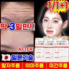 [일본기술] 팔자 미간 이마 주름 패치 눈가 눈밑 주름 리프팅 패치 아이 얼굴 눈 피부 케어 주름 개선 테이프, 2개
