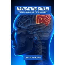 (英文圖書)Navigating Chiari: From diagnosis to treatment 平裝版, Independently Published, 英文