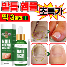 [국내배송] 발톱 거품나는앰플 솔루션 문제성발톱 앰플 발톱 곰팡이 한번에끝내는 손발톱 영양제 보장증정, 1개, 30ml