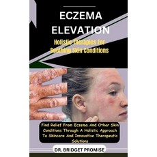 (영문도서) Eczema Elevation: Holistic Therapies For Soothing Skin Conditions: Find Relief From Eczema An... Paperback, Independently Published, English, 9798875955983