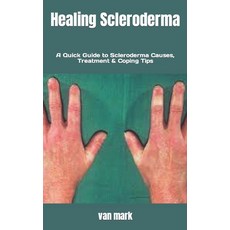 (영문도서) Healing Scleroderma: A Quick Guide to Scleroderma Causes Treatment & Coping Tips Paperback, Independently Published, English, 9798846974555