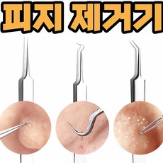 코피지 제거기 얼굴 피지 압출기 블랙헤드 뽑기 압출 won*3875Tg, 본상품선택, 바늘루프형