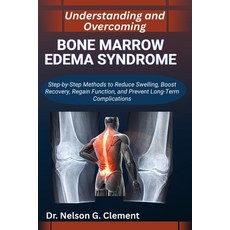 (영문도서)Understanding and Overcoming Bone Marrow Edema Syndrome: Step-by-Step Methods to... Paperback, Independently Published, English, 9798266899926