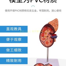 1:1 Lifesize 신장 부신 학교 부분 함 베이스 이동식 해부학 실험실 모델, A. 자연스러운 큰 신장 해부학