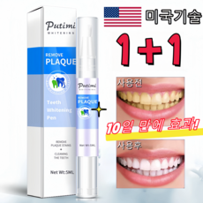 미국기술 치아미백제 누렁이 제거 치아미백 셀프 얼룩제거, 1개, 5ml