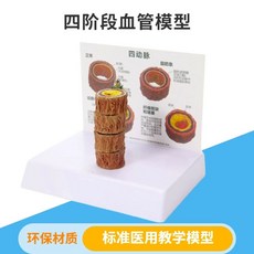 동맥경화 모형 혈관 폐쇄 내과 심혈관 모델 교육용 교구 비교, B. 4 단 혈관 모델
