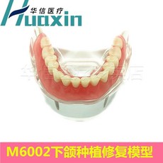 모형 치과 치아 교육용 이빨 교구 교육 모델 인체, V. M6002 턱 이식 및 수리 모델, 1개