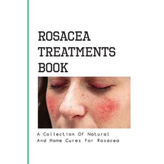 Rosacea Treatments Book- A Collection Of Natural And Home Cures For Rosacea: Rosacea Treatment Paperback, Independently Published, English, 9798579261052