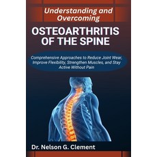(영문도서)Understanding and Overcoming Osteoarthritis of the Spine: Comprehensive Approach... Paperback, Independently Published, English, 9798266930704