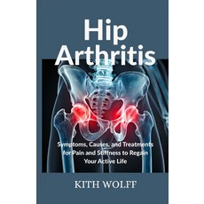 (英文圖書)Hip Arthritis: Symptoms Causes and Treatments for Pain and Stiffness to Regain... 平裝版, Independently Published, 英文