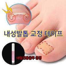 파고드는 발톱 셀프관리 테이프, 50매입, 1개