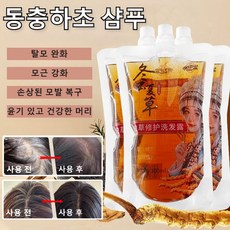 동충하초 오일 컨트롤 샴푸 지성두피 동충하초 한방 샴푸 탈모 증상 완화 기능성 동충하초 샴푸 고영양 샴푸 인텐스 리커버리 극손상 샴푸 모근강화 샴푸, 300ml, 1개