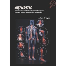 (영문도서)Arthritis: Understanding Risk Factors Symptom Recognition Treatment Options a... Paperback, Independently Published, English, 9798265375827