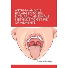 Asthma and an Enlarged Tonsil Natural and Simple Methods to Get Rid of Ailments Paperback, Dermosys, English, 9788366746008