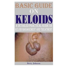 (영문도서) Basic Guide on Keloids: A detailed practical guide on keloid management and treatment Paperback, Independently Published, English, 9798860699762