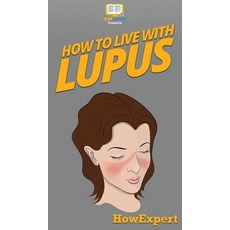 How To Live With Lupus: Your Step By Step Guide To Living With Lupus Hardcover, Howexpert