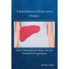 A Brief History of Fatty Liver Disease: How it Develops and Ways You can Prevent it's Progression Paperback, Independently Published