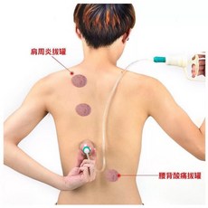 真空拔罐器10入組 出口專用 拔火罐 推拿 美體美容 中醫養生 民俗療法, 1個, 拔罐器