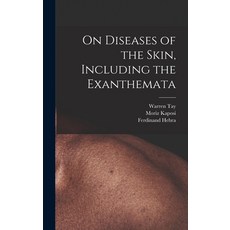 (영문도서) On Diseases of the Skin Including the Exanthemata Hardcover, Legare Street Press, English, 9781016507257