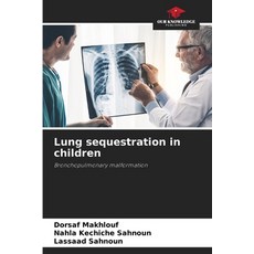 (영문도서) Lung sequestration in children Paperback, Our Knowledge Publishing, English, 9786208198602
