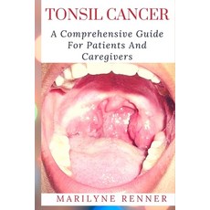 (영문도서) Tonsil Cancer: A Comprehensive Guide For Patients and Caregivers Paperback, Independently Published, English, 9798370367786