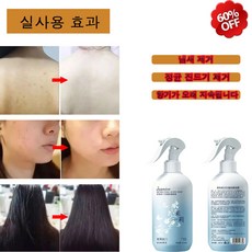 치슬 진드기 스프레이 소독 항균 가정용 침대 이불 애완 동물 진드기 제거 가정용임신애완동물정균소독, 500ml, 1개