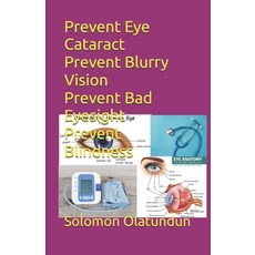 (영문도서)Prevent Eye Cataract Prevent Blurry Vision Prevent Bad Eyesight Prevent Blindness Paperback, Independently Published, English, 9798261837473