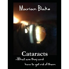 Cataracts: What are they and how to get rid of them? Paperback, Createspace Independent Pub..., English, 9781507738795
