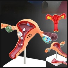 자궁모형 여자 생식기 인체모형 난소 병리학 부인과 교육 모델 신체 해부 구조 산부인과, A. 난소 자궁