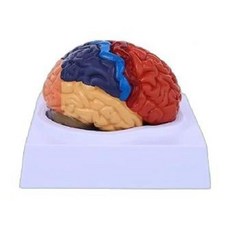 인체 신경 실제크기 조립 뇌혈관 혈관 모형 모델 뇌, 2. 병변형 모델