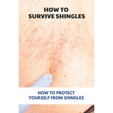 How To Survive Shingles: How To Protect Yourself From Shingles: How To Speed Up Shingles Recovery Paperback, Independently Published, English, 9798740452289
