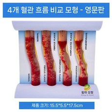 심혈관모형 동맥경화혈관모형 해부학 교육용 병원 심혈관 혈관모형 의학 단면 모델 경화, 네 개의 용기 흐름 비교 - 영어 버전