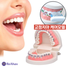 레아하브 덴트에듀 치과 모델 치아 교정 모형 치열 교정기 실습 틀니 연습 교구, 1세트