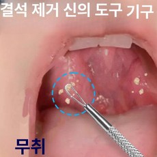 셀렉트하루 셀프편도결석제거기 구강관리 흡입기 치석, 5개 세트 석재 제거 도구, 기본 모델명/품번