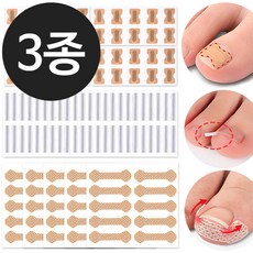 더로만 파고드는 발톱 자가관리, 150개