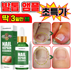 [국내배송] 발톱 거품나는앰플 솔루션 문제성발톱 앰플 발톱 곰팡이 한번에끝내는 손발톱 영양제 보장증정, 1개, 30ml