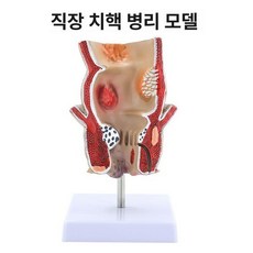 위장 대장 해부도 수업 병리 과학 병리학 소화기관 내과 모형 인체 교육, 기본 색상