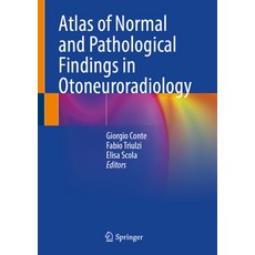 (外文書)Atlas of Normal and Pathological Findings in Otoneuroradiology Hardcover, Springer, English