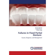 (영문도서)Failures in Fixed Partial Denture Paperback, LAP Lambert Academic Publis..., English, 9786209967238 LAP Lambert Academic Publis..., English, 9786209967238